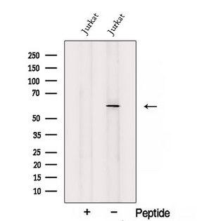 SLC38A1 / NaT2 Antibody - Western blot analysis of extracts of HepG2 cells using SLC38A1 antibody. The lane on the left was treated with blocking peptide.