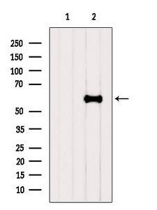 SLC38A1 / NaT2 Antibody