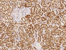 SLC38A1 / NaT2 Antibody - Immunochemical staining of human SLC38A1 in human kidney with rabbit polyclonal antibody at 1:100 dilution, formalin-fixed paraffin embedded sections.