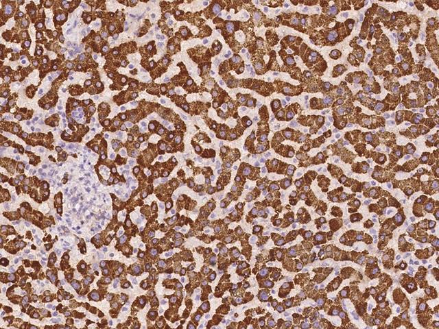 SLC38A1 / NaT2 Antibody - Immunochemical staining of human SLC38A1 in human liver with rabbit polyclonal antibody at 1:100 dilution, formalin-fixed paraffin embedded sections.