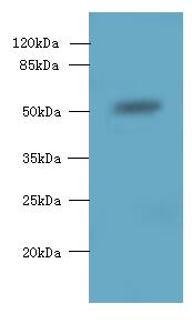 SLC38A2 / SNAT2 Antibody - Western blot. All lanes: SLC38A2 antibody at 1.5 ug/ml+ A431 whole cell lysate Goat polyclonal to rabbit at 1:10000 dilution. Predicted band size: 54 kDa. Observed band size: 54 kDa.