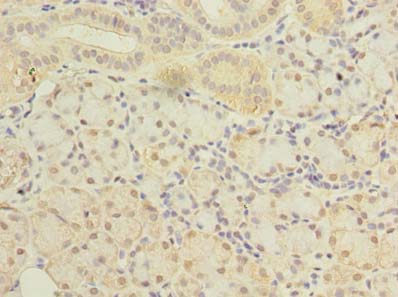 SLC38A2 / SNAT2 Antibody - Immunohistochemistry of paraffin-embedded human pancreatic tissue using antibody at dilution of 1:100.