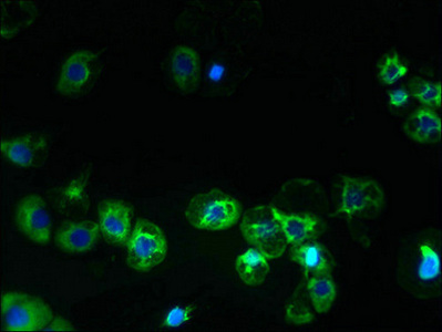 SLC38A2 / SNAT2 Antibody - Immunofluorescent analysis of A431 cells using SLC38A2 Antibody at dilution of 1:100 and Alexa Fluor 488-congugated AffiniPure Goat Anti-Rabbit IgG(H+L)