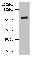 SLC38A2 / SNAT2 Antibody - Western blot All lanes: SLC38A2 antibody at 1.5µg/ml + A431 whole cell lysate Secondary Goat polyclonal to rabbit IgG at 1/10000 dilution Predicted band size: 57, 46 kDa Observed band size: 57 kDa
