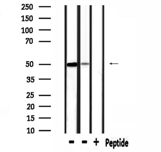 SLC38A2 / SNAT2 Antibody - Western blot analysis of extracts of mouse lung and mouse brain tissue using SLC38A2 antibody.
