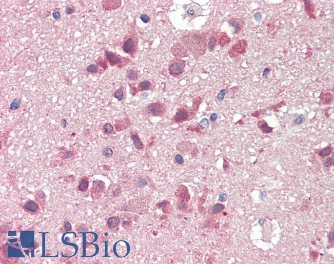 SLC38A2 / SNAT2 Antibody - Anti-SLC38A2 / SNAT2 antibody IHC staining of human brain, cortex. Immunohistochemistry of formalin-fixed, paraffin-embedded tissue after heat-induced antigen retrieval. Antibody concentration 5 ug/ml.  This image was taken for the unconjugated form of this product. Other forms have not been tested.