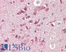 SLC38A2 / SNAT2 Antibody - Anti-SLC38A2 / SNAT2 antibody IHC staining of human brain, cortex. Immunohistochemistry of formalin-fixed, paraffin-embedded tissue after heat-induced antigen retrieval. Antibody concentration 5 ug/ml.  This image was taken for the unconjugated form of this product. Other forms have not been tested.