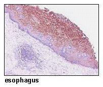 SLC38A2 / SNAT2 Antibody - Human esophagus, FFPE