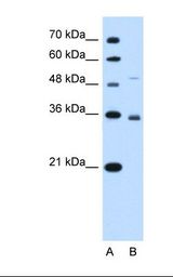 SLC38A3 / SNAT3 Antibody - Lane A: Marker. Lane B: HepG2 cell lysate. Anti-SLC38A3 Antibody concentration: 1.0 ug/ml. Gel concentration: 12%.  This image was taken for the unconjugated form of this product. Other forms have not been tested.