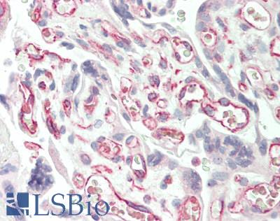 SLC38A3 / SNAT3 Antibody - Human Placenta: Formalin-Fixed, Paraffin-Embedded (FFPE).  This image was taken for the unconjugated form of this product. Other forms have not been tested.