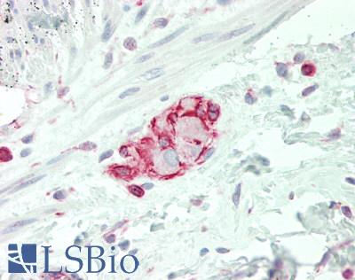 SLC38A3 / SNAT3 Antibody - Human Colon, Submucosal Plexus: Formalin-Fixed, Paraffin-Embedded (FFPE).  This image was taken for the unconjugated form of this product. Other forms have not been tested.