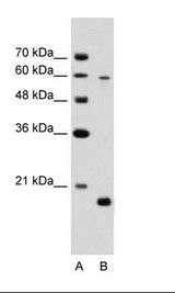 SLC38A4 / SNAT4 Antibody - A: Marker, B: Jurkat Cell Lysate.  This image was taken for the unconjugated form of this product. Other forms have not been tested.