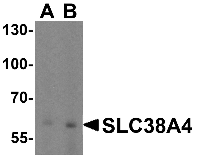 SLC38A4 / SNAT4 Antibody - Western blot analysis of SLC38A4 in mouse kidney tissue lysate with SLC38A4 antibody at (A) 1 and (B) 2 ug/ml.