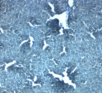 SLC38A4 / SNAT4 Antibody - Immunohistochemistry of SLC38A4 in mouse liver tissue with SLC38A4 antibody at 2.5 ug/mL.