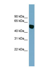 SLC38A5 Antibody - SLC38A5 antibody Western blot of THP-1 cell lysate. This image was taken for the unconjugated form of this product. Other forms have not been tested.