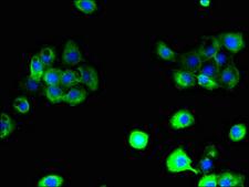 SLC38A6 Antibody - Immunofluorescent analysis of A431 cells using SLC38A6 Antibody at dilution of 1:100 and Alexa Fluor 488-congugated AffiniPure Goat Anti-Rabbit IgG(H+L)
