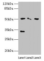 SLC38A6 Antibody - Western blot All lanes: SLC38A6 antibody at 12µg/ml Lane 1: Mouse kidney tissue Lane 2: Mouse thymus tissue Lane 3: U87 whole cell lysate Secondary Goat polyclonal to rabbit IgG at 1/10000 dilution Predicted band size: 51, 58 kDa Observed band size: 51, 33 kDa