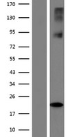 SLC38A6 Protein - Western validation with an anti-DDK antibody * L: Control HEK293 lysate R: Over-expression lysate