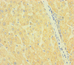SLC38A9 Antibody - Immunohistochemistry of paraffin-embedded human liver tissue at dilution of 1:100