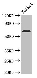 SLC38A9 Antibody - Western Blot Positive WB detected in:Jurkat whole cell lysate All Lanes: SLC38A9 antibody at 3.5ug/ml Secondary Goat polyclonal to rabbit IgG at 1/50000 dilution Predicted band size: 64,53,57 kDa Observed band size: 64 kDa