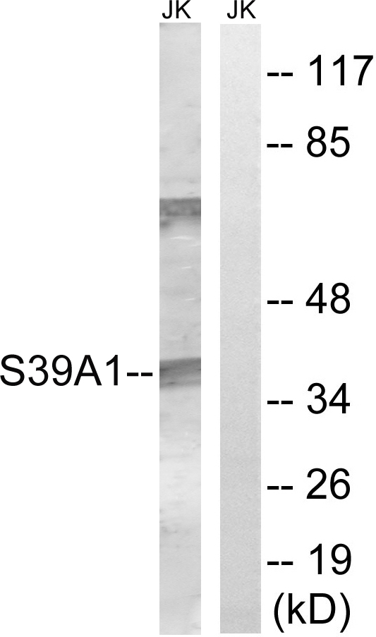 SLC39A1 Antibody - Western blot analysis of lysates from Jurkat cells, using SLC39A1 Antibody. The lane on the right is blocked with the synthesized peptide.