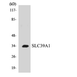 SLC39A1 Antibody - Western blot analysis of the lysates from COLO205 cells using SLC39A1 antibody.