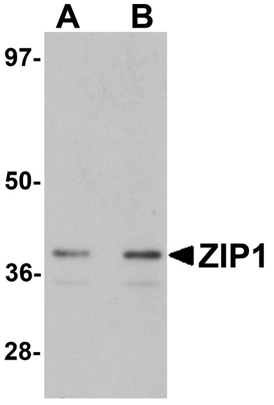 SLC39A1 Antibody - Western blot analysis of ZIP1 in mouse kidney tissue lysate with ZIP1 antibody at (A) 1 and (B) 2 ug/ml.