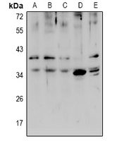 SLC39A1 Antibody - Western blot analysis of ZIP1 expression in H1792 (A), LO2 (B), HCT116 (C), PC12 (D), AML12 (E) whole cell lysates.