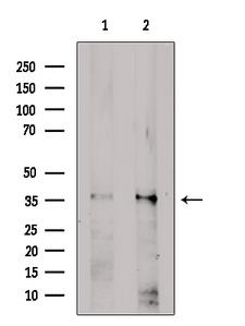 SLC39A1 Antibody - Western blot analysis of extracts of various samples using SLC39A1 antibody. Lane 1: HepG2; Lane 2: rat brain;