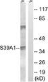 SLC39A1 Antibody - Western blot analysis of extracts from Jurkat cells, using SLC39A1 antibody.