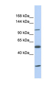 SLC39A10 / ZIP10 Antibody - SLC39A10 antibody Western blot of Fetal Heart lysate. This image was taken for the unconjugated form of this product. Other forms have not been tested.