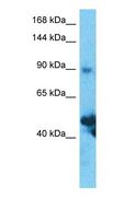 SLC39A10 / ZIP10 Antibody - Western blot of SLC39A10 Antibody with human Thymus Tumor lysate.  This image was taken for the unconjugated form of this product. Other forms have not been tested.