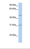 SLC39A11 / ZIP11 Antibody - 721_B cell lysate. Antibody concentration: 1.0 ug/ml. Gel concentration: 12%.  This image was taken for the unconjugated form of this product. Other forms have not been tested.