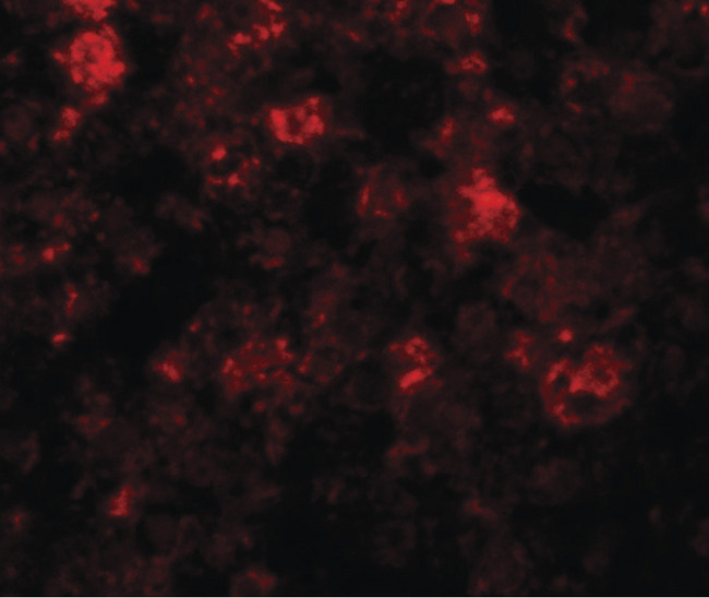 SLC39A12 / ZIP12 Antibody - Immunofluorescence of ZIP12 in mouse liver tissue with ZIP12 antibody at 20 ug/ml.