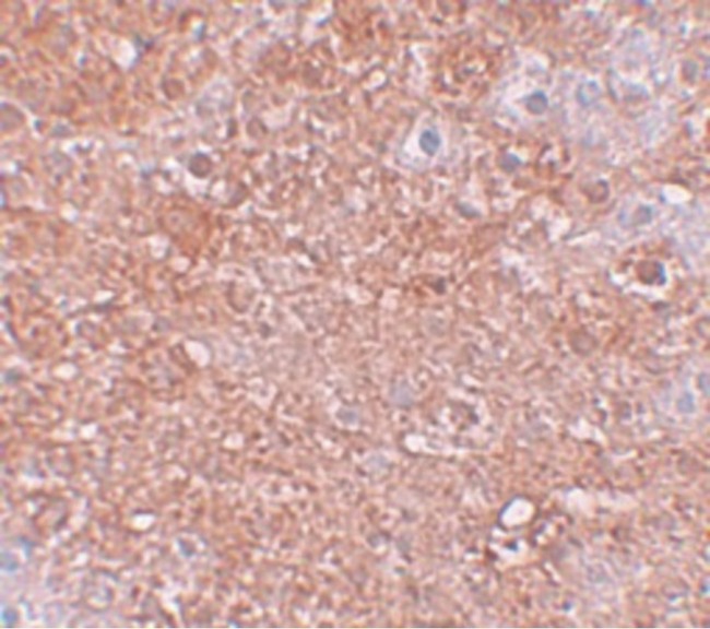 SLC39A12 / ZIP12 Antibody - Immunohistochemistry of ZIP12 in mouse liver tissue with ZIP12 antibody at 2.5 ug/ml.