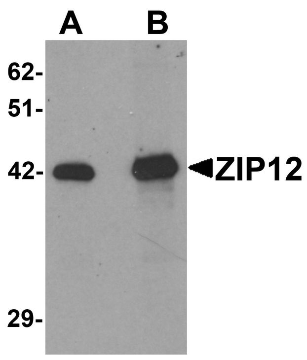 SLC39A12 / ZIP12 Antibody - Western blot analysis of ZIP12 in HepG2 cell lysate with ZIP12 antibody at (A) 0.5 and (B) 1 ug/ml.