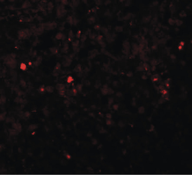 SLC39A13 / ZIP13 Antibody - Immunofluorescence of ZIP13 in human spleen tissue with ZIP13 antibody at 20 ug/ml.