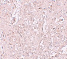 SLC39A13 / ZIP13 Antibody - Immunohistochemistry of ZIP13 in human spleen tissue with ZIP13 antibody at 2.5 ug/ml.