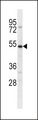 SLC39A14 / ZIP14 Antibody - SLC39A14 Antibody western blot of U251 cell line lysates (35 ug/lane). The SLC39A14 antibody detected the SLC39A14 protein (arrow).