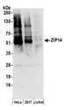 SLC39A14 / ZIP14 Antibody - Detection of human ZIP14 by western blot. Samples: Whole cell lysate (50 µg) from HeLa, HEK293T, and Jurkat cells prepared using RIPA lysis buffer. Antibodies: Affinity purified rabbit anti-ZIP14 antibody used for WB at 0.1 µg/ml. Detection: Chemiluminescence with an exposure time of 3 minutes.
