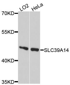 SLC39A14 / ZIP14 Antibody - Western blot analysis of extracts of various cell lines, using SLC39A14 antibody at 1:1000 dilution. The secondary antibody used was an HRP Goat Anti-Rabbit IgG (H+L) at 1:10000 dilution. Lysates were loaded 25ug per lane and 3% nonfat dry milk in TBST was used for blocking. An ECL Kit was used for detection and the exposure time was 30s.