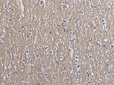 SLC39A14 / ZIP14 Antibody - Immunohistochemistry of paraffin-embedded Human brain tissue  using SLC39A14 Polyclonal Antibody at dilution of 1:40(×200)