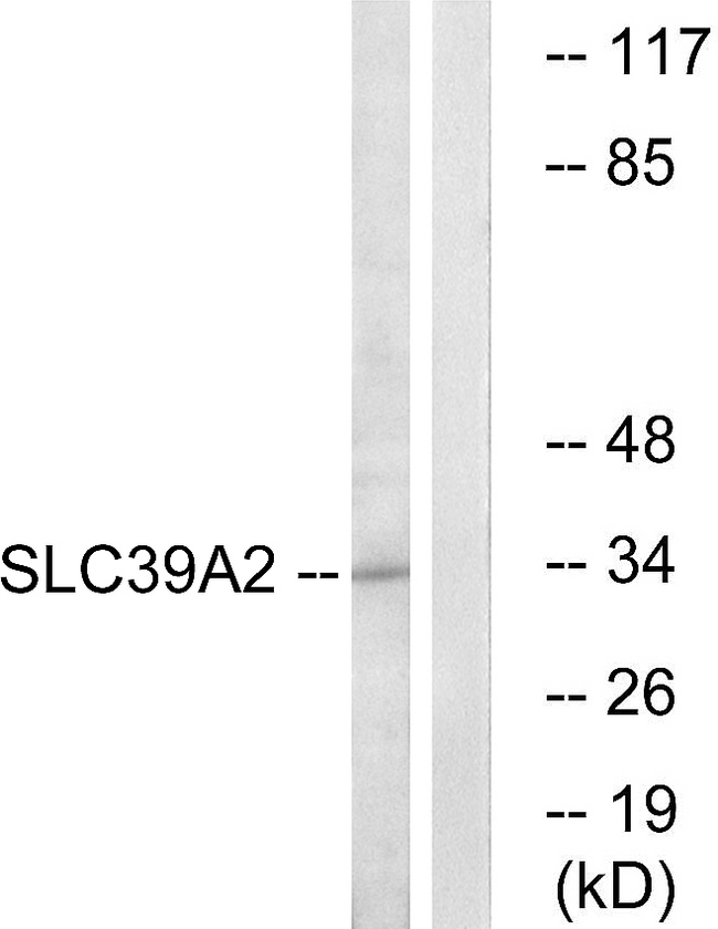 SLC39A2 / ZIP2 Antibody - Western blot analysis of lysates from Jurkat cells, using SLC39A2 Antibody. The lane on the right is blocked with the synthesized peptide.