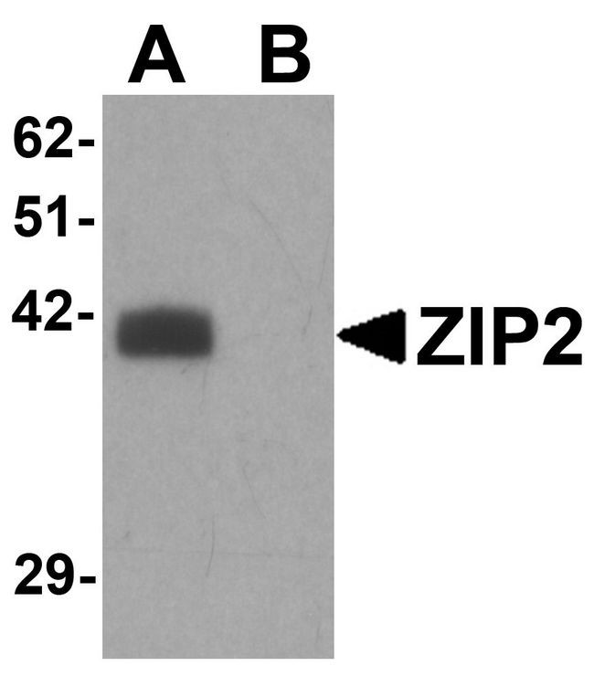 SLC39A2 / ZIP2 Antibody - Western blot analysis of ZIP2 in rat brain tissue lysate with ZIP2 antibody at 1 ug/ml in (A) the absence and (B) the presence of blocking peptide.