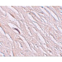SLC39A2 / ZIP2 Antibody - Immunohistochemistry of ZIP2 in human brain tissue with ZIP2 antibody at 2.5 µg/mL.