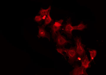 SLC39A2 / ZIP2 Antibody - Staining HeLa cells by IF/ICC. The samples were fixed with PFA and permeabilized in 0.1% Triton X-100, then blocked in 10% serum for 45 min at 25°C. The primary antibody was diluted at 1:200 and incubated with the sample for 1 hour at 37°C. An Alexa Fluor 594 conjugated goat anti-rabbit IgG (H+L) Ab, diluted at 1/600, was used as the secondary antibody.