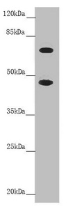 SLC39A4 / ZIP4 Antibody - Western blot All Lanes:SLC39A4 antibody at 4.45 ug/ml +Colo320 whole cell lysate Secondary Goat polyclonal to rabbit IgG at 1/10000 dilution Predicted band size: 69,67 kDa Observed band size: 68,47 kDa