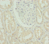 SLC39A4 / ZIP4 Antibody - Immunohistochemistry of paraffin-embedded human kidney tissue at dilution 1:100