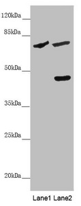 SLC39A4 / ZIP4 Antibody - Western blot All Lanes: SLC39A4 antibody at 5 ug/ml Lane 1: Mouse stomach tissue Lane 2: 293T whole cell lysate Secondary Goat polyclonal to rabbit IgG at 1/10000 dilution Predicted band size: 69,67 kDa Observed band size: 68,47 kDa