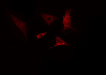 SLC39A4 / ZIP4 Antibody - Staining COLO205 cells by IF/ICC. The samples were fixed with PFA and permeabilized in 0.1% Triton X-100, then blocked in 10% serum for 45 min at 25°C. The primary antibody was diluted at 1:200 and incubated with the sample for 1 hour at 37°C. An Alexa Fluor 594 conjugated goat anti-rabbit IgG (H+L) antibody, diluted at 1/600, was used as secondary antibody.